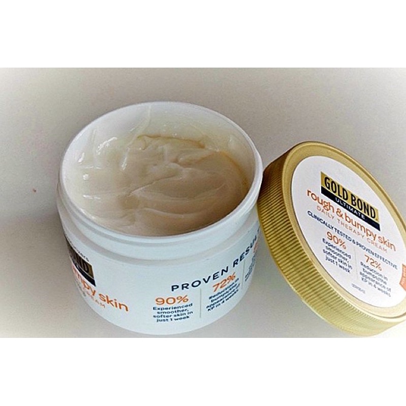 [AUTH-ĐỦ BILL] KEM DƯỠNG DA GOLD BOND ULTIMATE ROUGH & BUMPY SKIN | BigBuy360 - bigbuy360.vn
