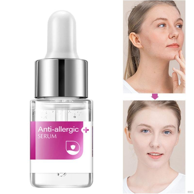 [Hàng mới về] Serum Hyaluronic Acid Chống Dị Ứng Phục Hồi Da Nhạy Cảm Laikou 12ml