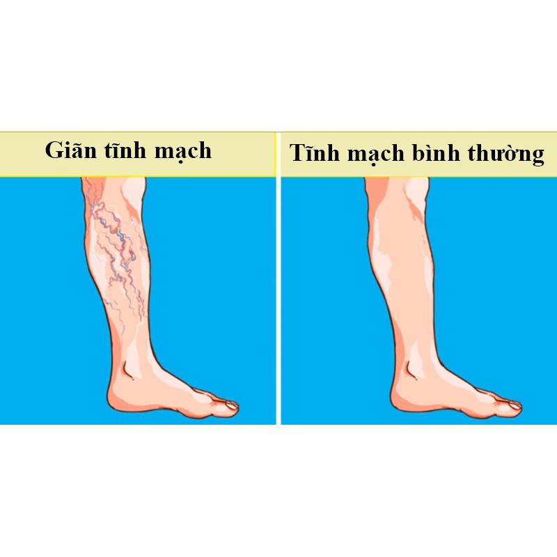 Kem Bôi Giãn Tĩnh Mạch [NỘI ĐỊA ĐỨC] Abtei Venen Aktiv cải thiện lưu thông máu, 125 ml