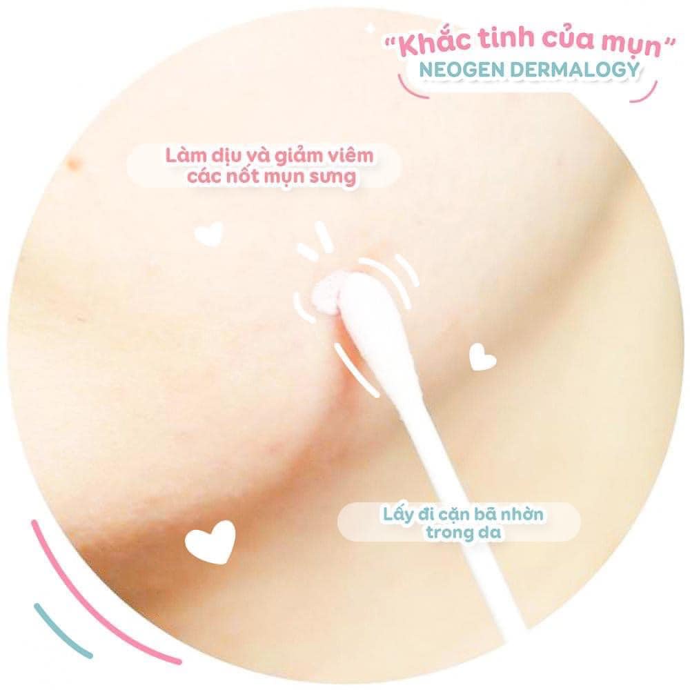 Chấm Mụn Neogen 2 Lớp Xẹp Mụn Sau 4H