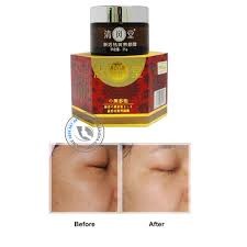 Kem vua nám Nhật Bản