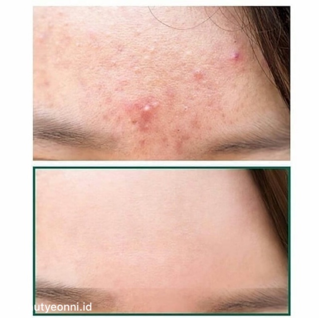 [Chính hãng] Phấn Nước Che Phủ Tốt, Giúp Dưỡng Ẩm Và Làm Dịu Da Some By Mi Killing Cover Moisture Cushion | BigBuy360 - bigbuy360.vn