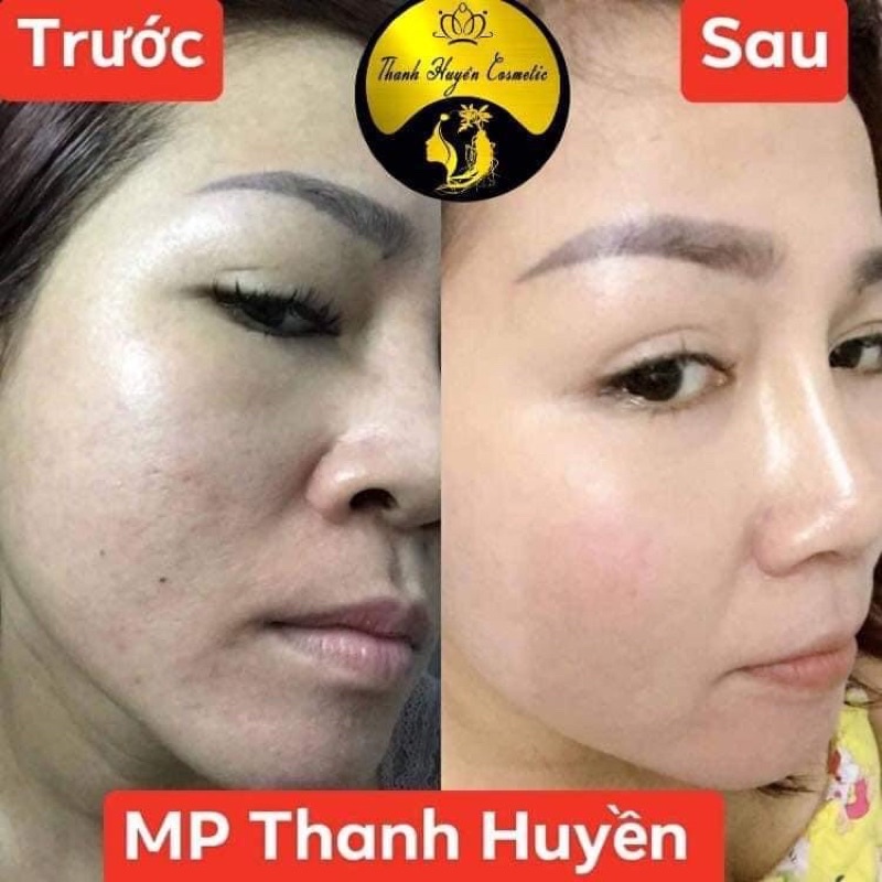 Đản bảo hiêu quả ngay từ bộ đâu tiên AMY COLAGEN