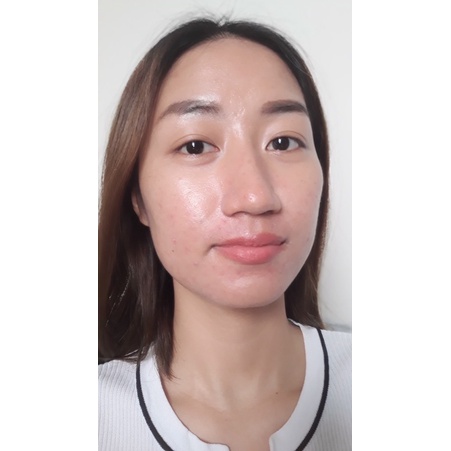 Kem ngừa mụn đẩy nhân mụn, mờ thâm +Dr.Lee Cream | BigBuy360 - bigbuy360.vn