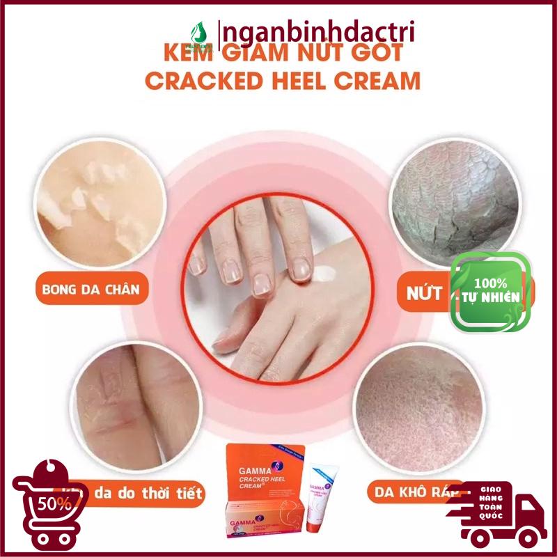 Kem Gamma Cracked Heel, kem giảm nứt gót chân,da khô, nẻ,...chuyên dùng cho da khô nứt nẻ cho kết quả cực kỳ tốt.