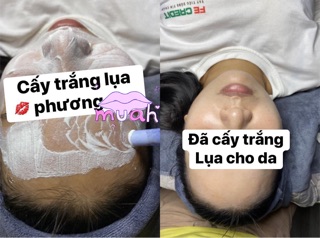 Cấy trắng spa handmade