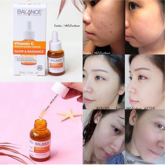 Serum vitamin C mờ thâm dưỡng trắng da phục hồi da