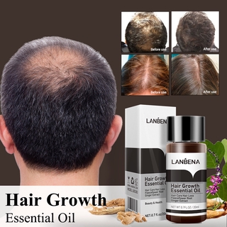 Tinh Dầu Lanbena Kích Mọc Tóc 20Ml