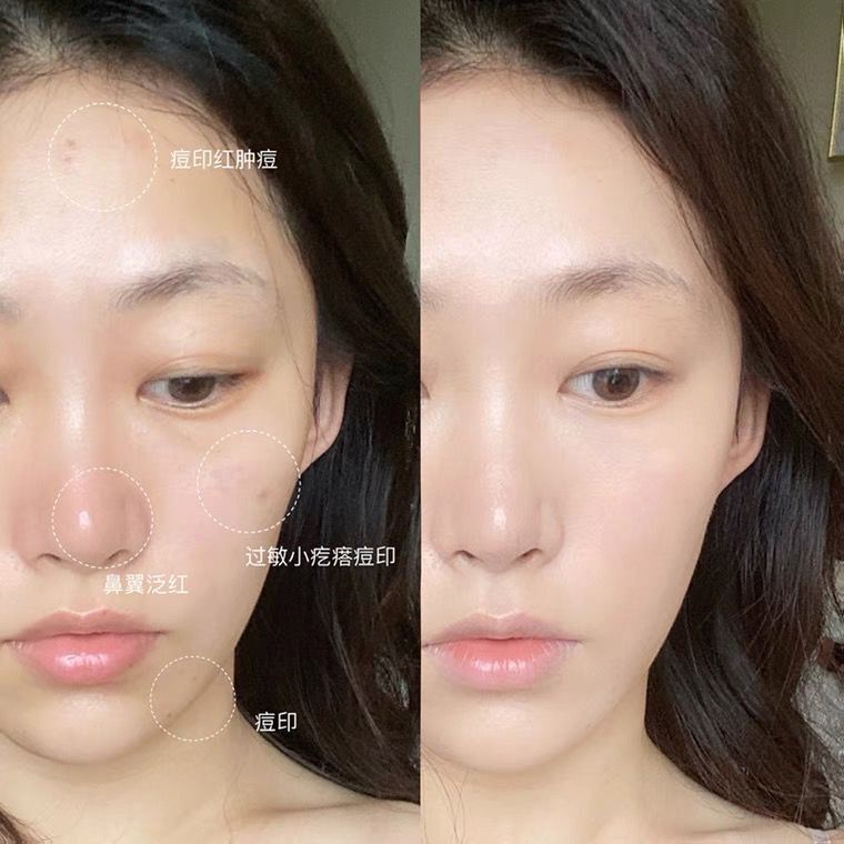 Unny Club Kem nền che khuyết điểm dạng lỏng dưỡng ẩm làm sáng tông màu da không tì vết | BigBuy360 - bigbuy360.vn