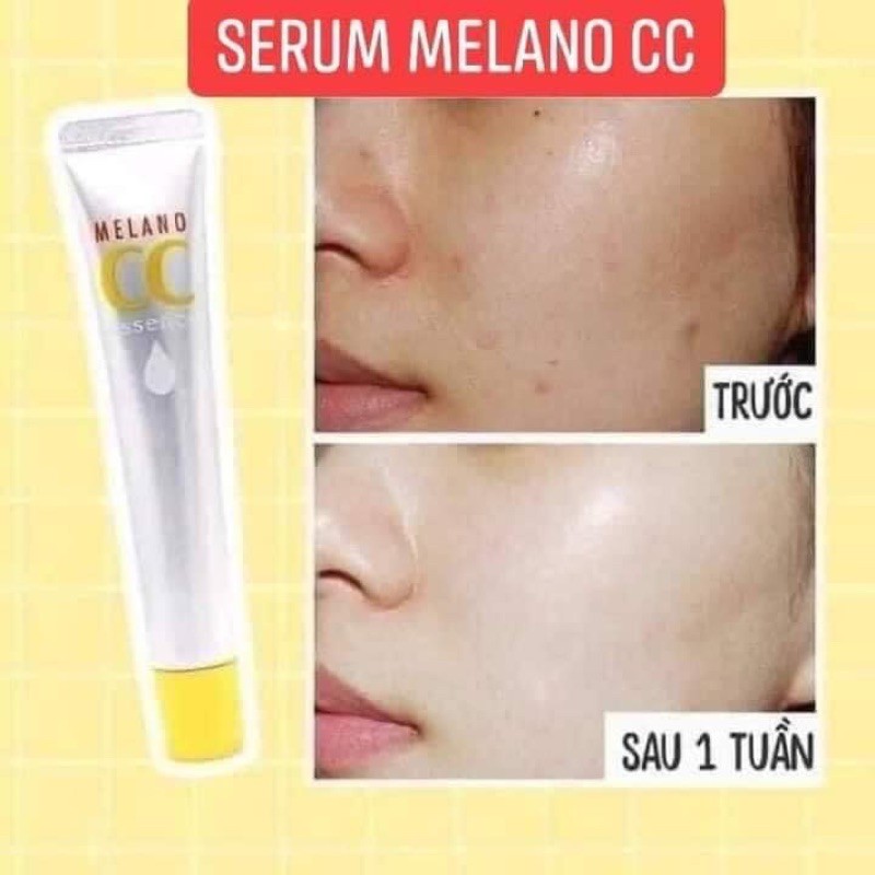 Tinh chất serum dưỡng trắng da chống thâm nám Melano CC Whitening Essence 20ml