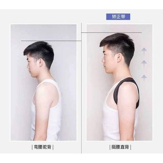 ĐAI CHỐNG GÙ LƯNG CONG VẸO CỘT SỐNG