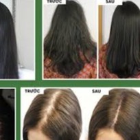 [ RR LINE ] Dầu Gội Chống Rụng & Kích Thích Mọc Tóc Therapy Star Shampoo
