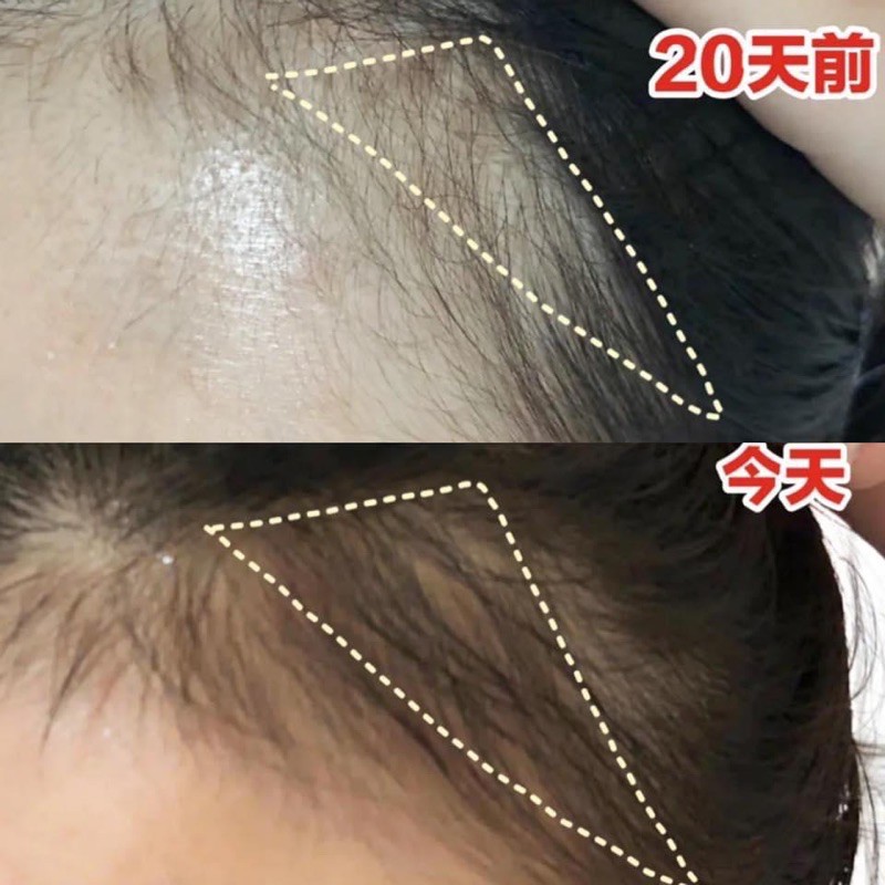 [ Tặng Bình Xịt ] Tinh Chất Kích Mọc Tóc Nhật Bản Sato | BigBuy360 - bigbuy360.vn