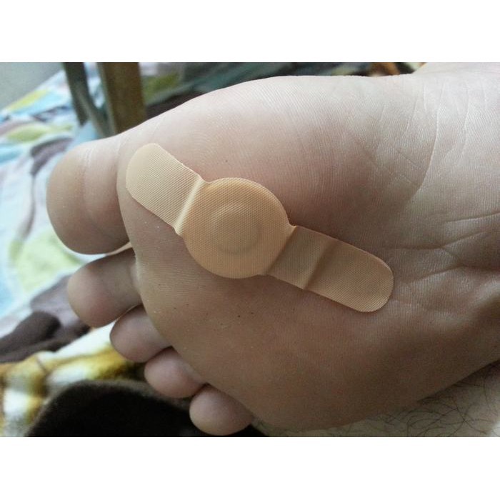 Miếng dán mụn cóc mắt cá chân CONR CAPS  của Anh