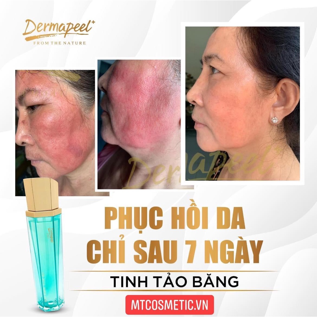 Dermapeel TINH TẢO BĂNG - ICED CRYSTAL SEAWEED SERUM - GIẢM TÌNH TRẠNG DA SƯNG ĐỎ NHANH CHÓNG - PHỤC HỒI DA HƯ TỔN 100ml