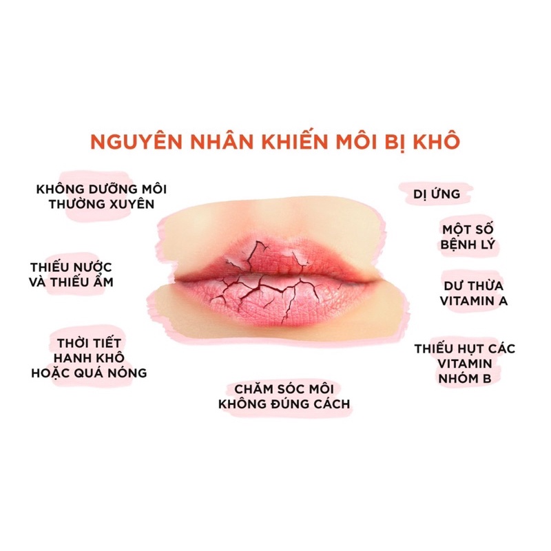 son dưỡng MỀM+ ThÂM môi DHC lip cream