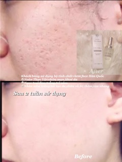Kem face trắng da Hàn Quốc