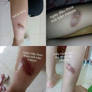 Mỡ trăn N'store