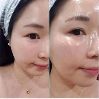 [Hàng chính hãng] Serum  cấp nước cho da dầu mụn Comodex Hydrate Restore Serum