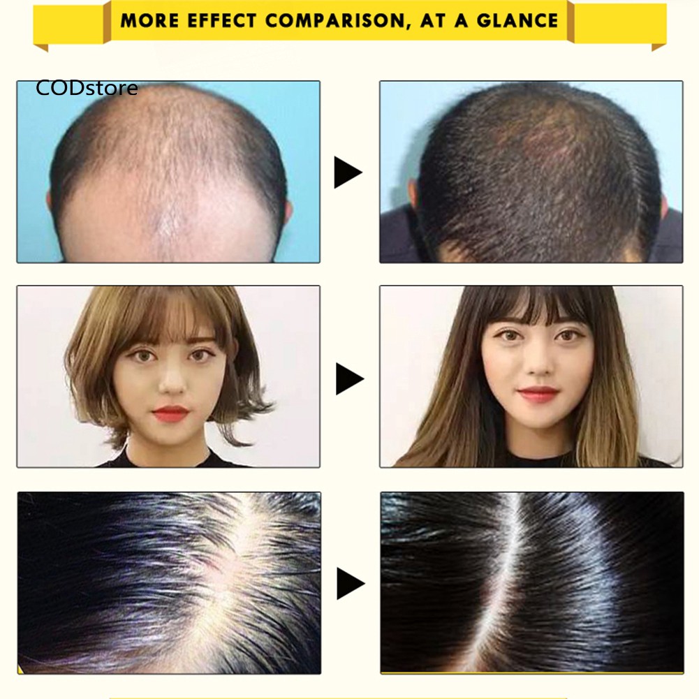 [Hàng mới về] Tinh chất nhân sâm hỗ trợ kích mọc tóc nhanh 20ml