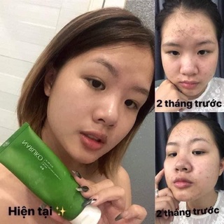 Sữa rửa mặt Naruko Tràm Trà 120m [Chính Hãng]