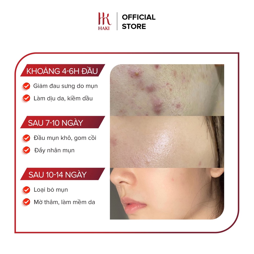 Serum Ngừa mụn HAKI Gingem Acne Sạch Mụn Sáng Da 15ml