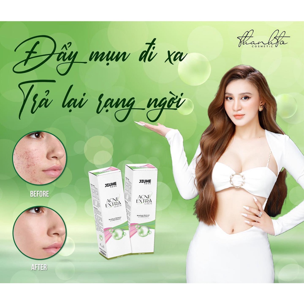 Serum Mụn Jiuhe Thanh Tô Acne Extra chính hãng Thanh Tô - Làm sáng vùng da thâm mụn và giảm dầu nhờn