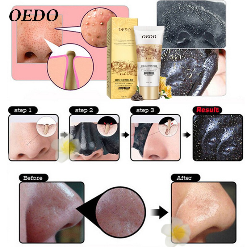 OEDO Volcanic Super Exfoliating Pore Mask Peeling Blackhead Whitening Mask