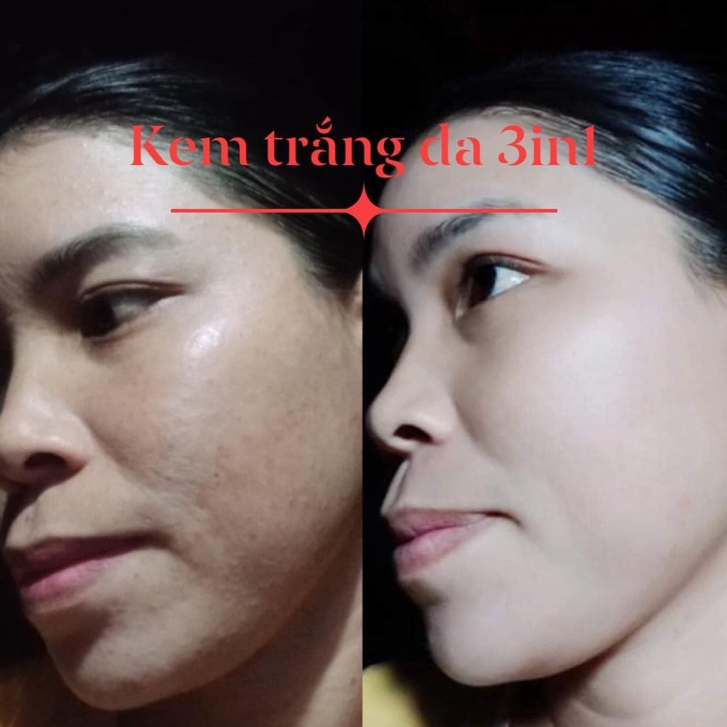 Kem face 3in1 dưỡng trắng da cải thiện mụn, nám, tàn nhang  Mỹ Mam