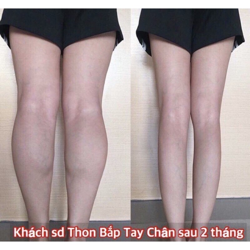 Serum tinh chất thon gọn bắp tay bắp chân - Hàn Quốc (20ml)