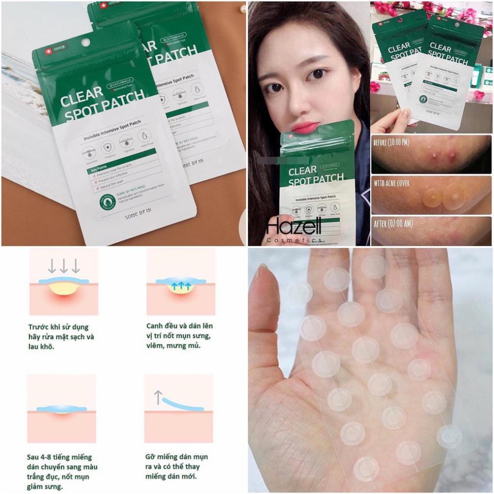 [Chính Hãng] Miếng Dán Ngừa Mụn - Some By Mi Clear Spot Patch (18 Miếng) | BigBuy360 - bigbuy360.vn