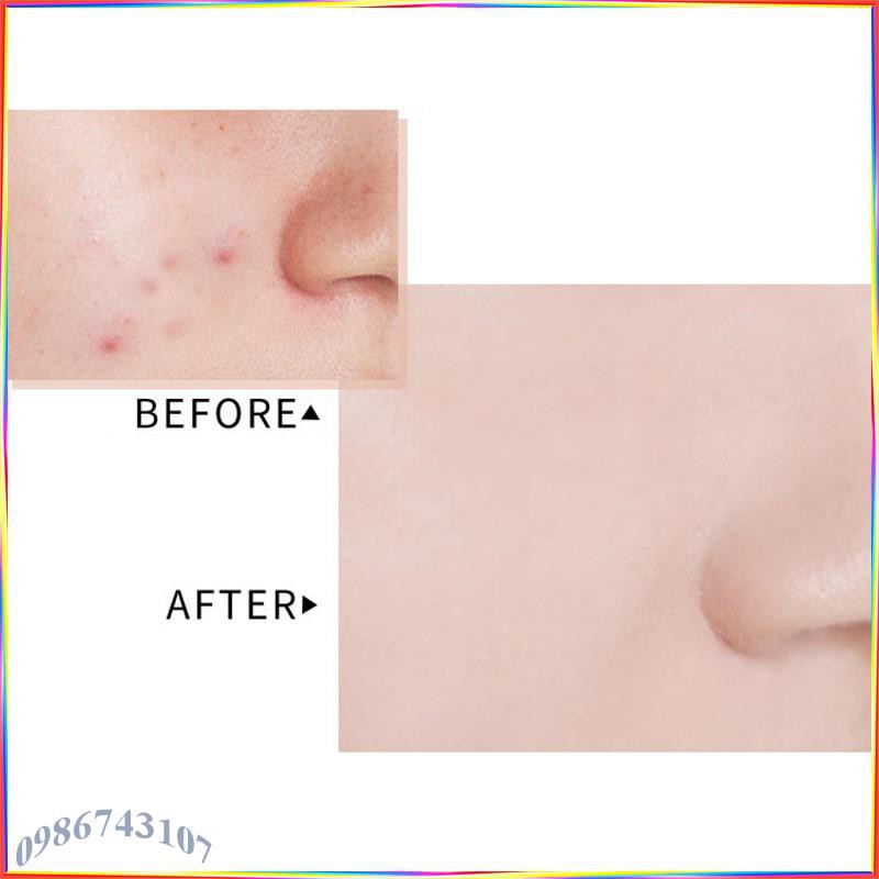 Kem nền che khuyết WodWod Perfect Beauty Concealer APC4 | BigBuy360 - bigbuy360.vn