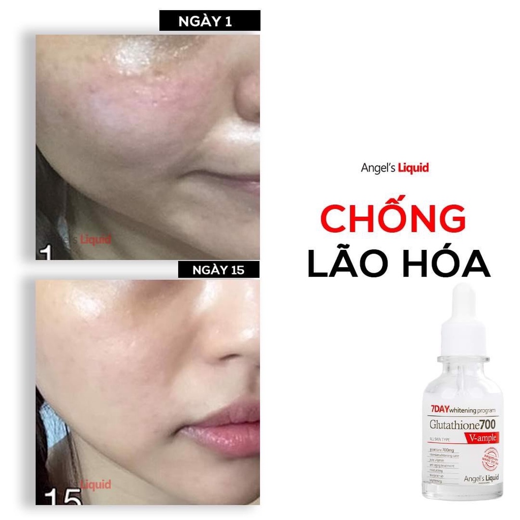 Serum Dưỡng Trắng Và Cấp Ẩm Angel's Liquid 7day Whitening Program Glutathione 700 V-Ample 30ml