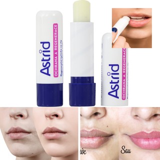 Son dưỡng mỡ hươu astrid - son trị thăm môi astrid