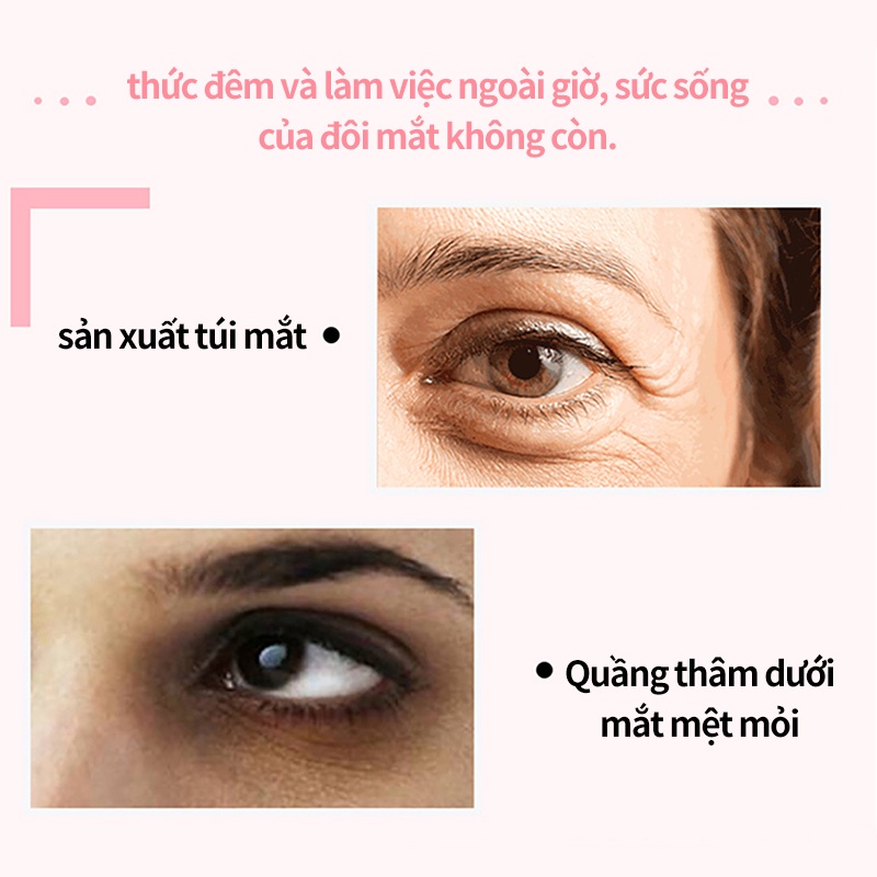 Kem dưỡng da vùng mắt ZA làm mờ nếp nhăn nâng cơ dưỡng ẩm làm săn chắc da mắt cao cấp 20g