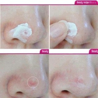 Kem Chấm Mụn Ciracle Red Spot Healing Cream