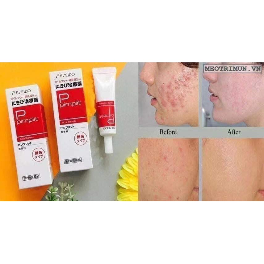 KEM LÀM GIẢM MỤN SHISEIDO PIMPLIT