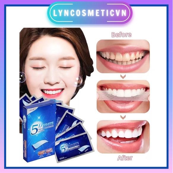 Miếng dán trắng răng tiện lợi 5D White Teeth Whitening Strips