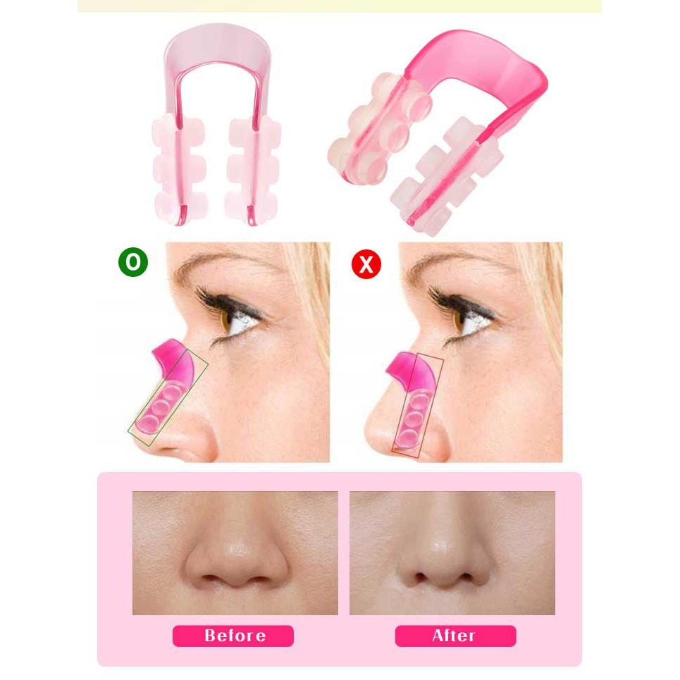 Dụng Cụ Kẹp Nâng Mũi An Toàn Dễ Dàng