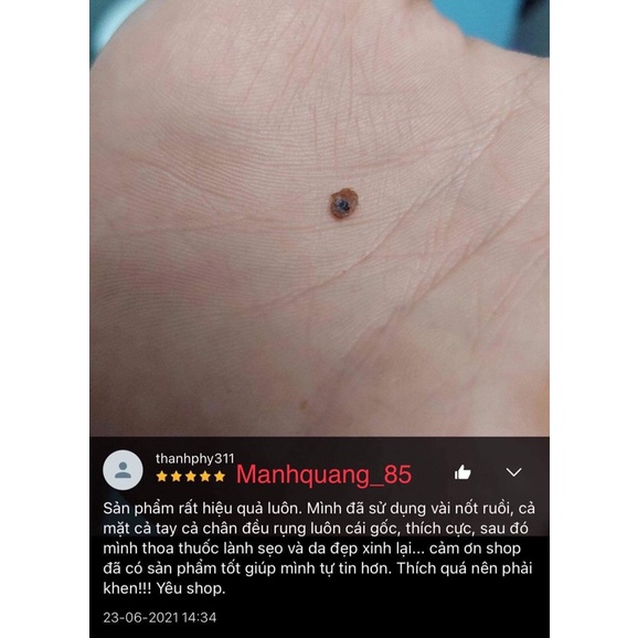 Tẩy xoá nốt ruồi,tàn nhang,mụn cóc,mụn thịt ,mụn cơm, mắt cá | BigBuy360 - bigbuy360.vn