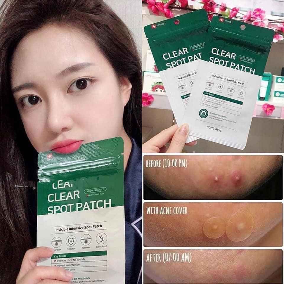 Miếng dán mụn Hàn Quốc Clear Spot Patch