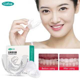 Cofoe Dụng Cụ Niềng Răng Trong Suốt Tiện Dụng Chất Lượng Cao