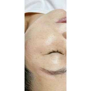 Serum Detox Tái Tạo Da