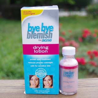 Lotion Chấm Xẹp Mụn Cấp Tốc Bye Bye Blemish Drying Lotion