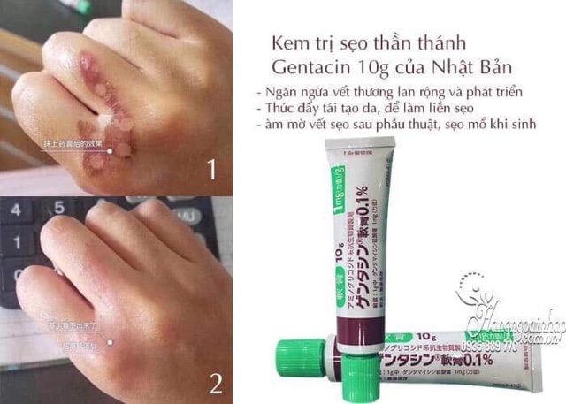 Kem Gentacin ngừa mụn chính hãng Nhật