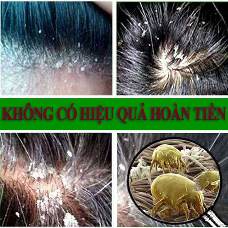 Dầu gội đầu muối biển dầu gội đầu loại bỏ gàu dầu gội loại bỏ tế bào chết dầu gội chống ngứa 500ml loại bỏ ngứa ngáy