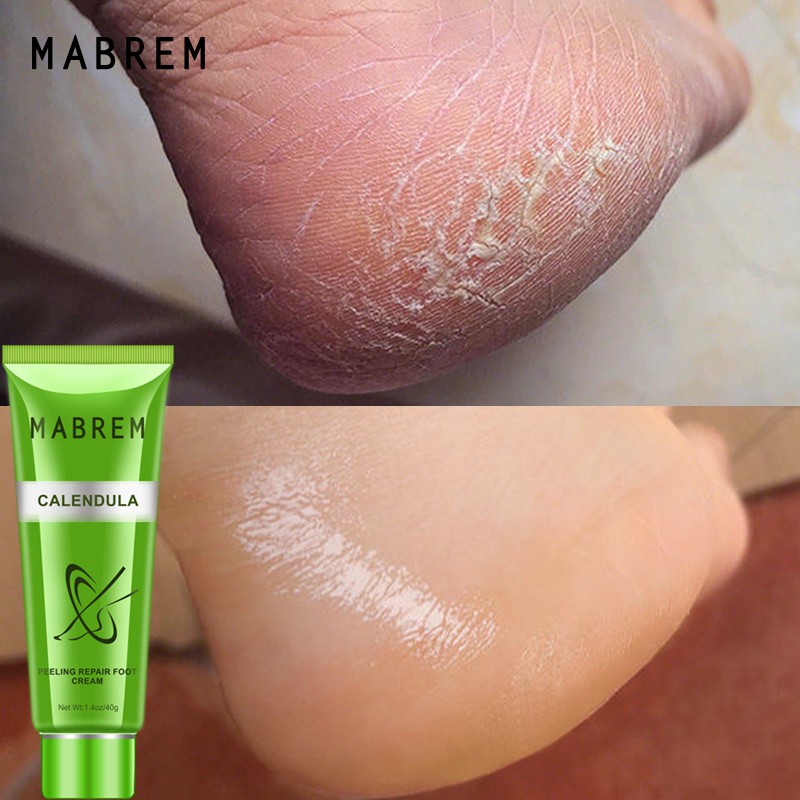 [Hàng mới về] Kem olive calendula Mabrem tẩy tế bào chết dưỡng ẩm chống khô chăm sóc da chân 40g