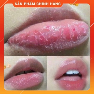ủ môi lanege
