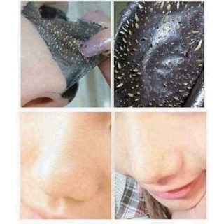 Gel lột mụn Charcoal