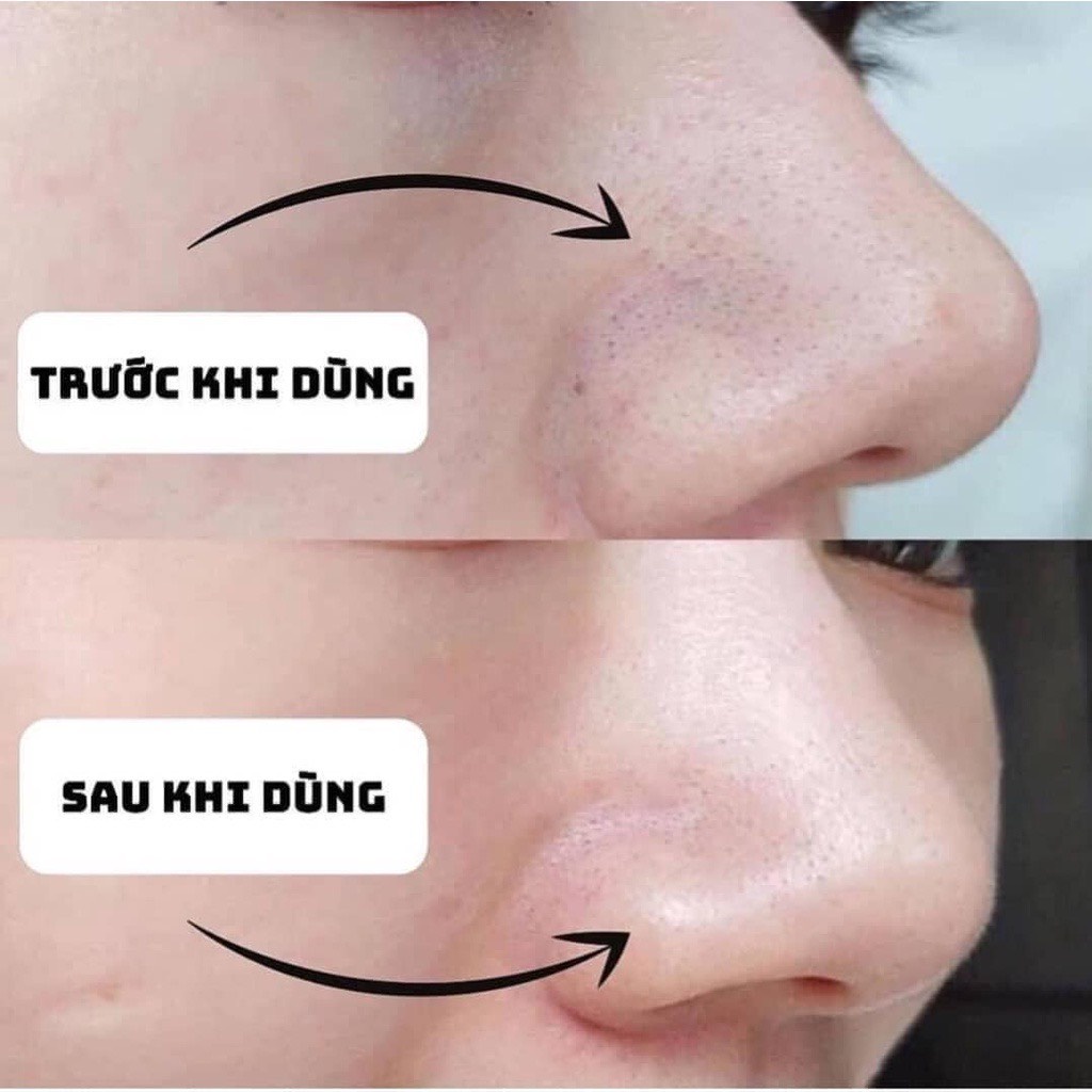 Thanh Lăn Hút Mụn Mamonde Pore Clean Black Head Stick